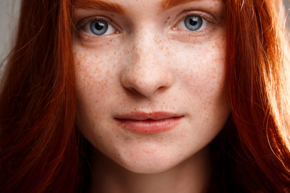 Melasma and pigmentation treatment