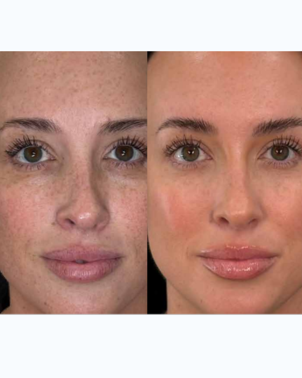 BBL HEROic and Moxi before and after