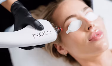 MOXI Skin Resurfacing