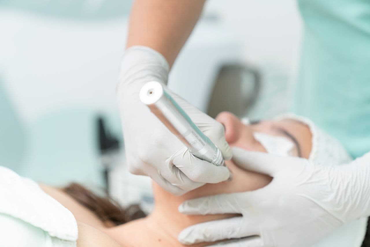 Botox consultation